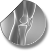 Introduction for knee arthroscopy